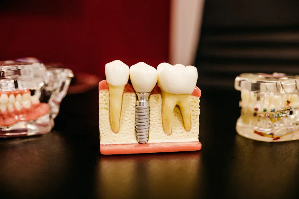 What Does a Cavity Look Like?