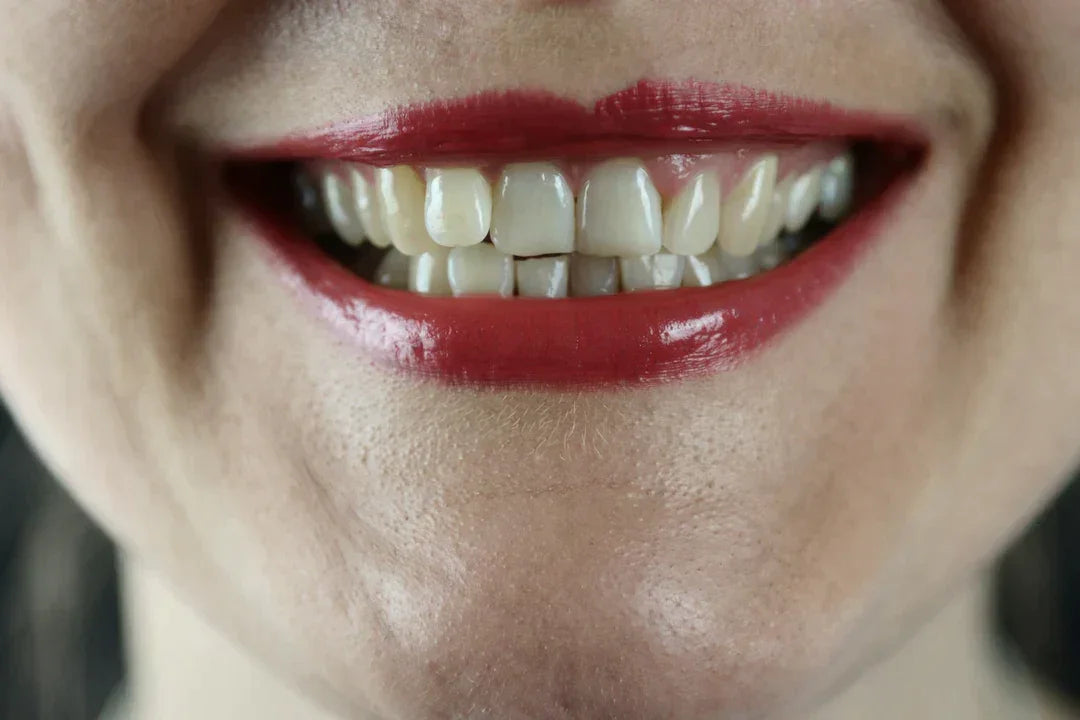 How Much Does Teeth Whitening Cost?