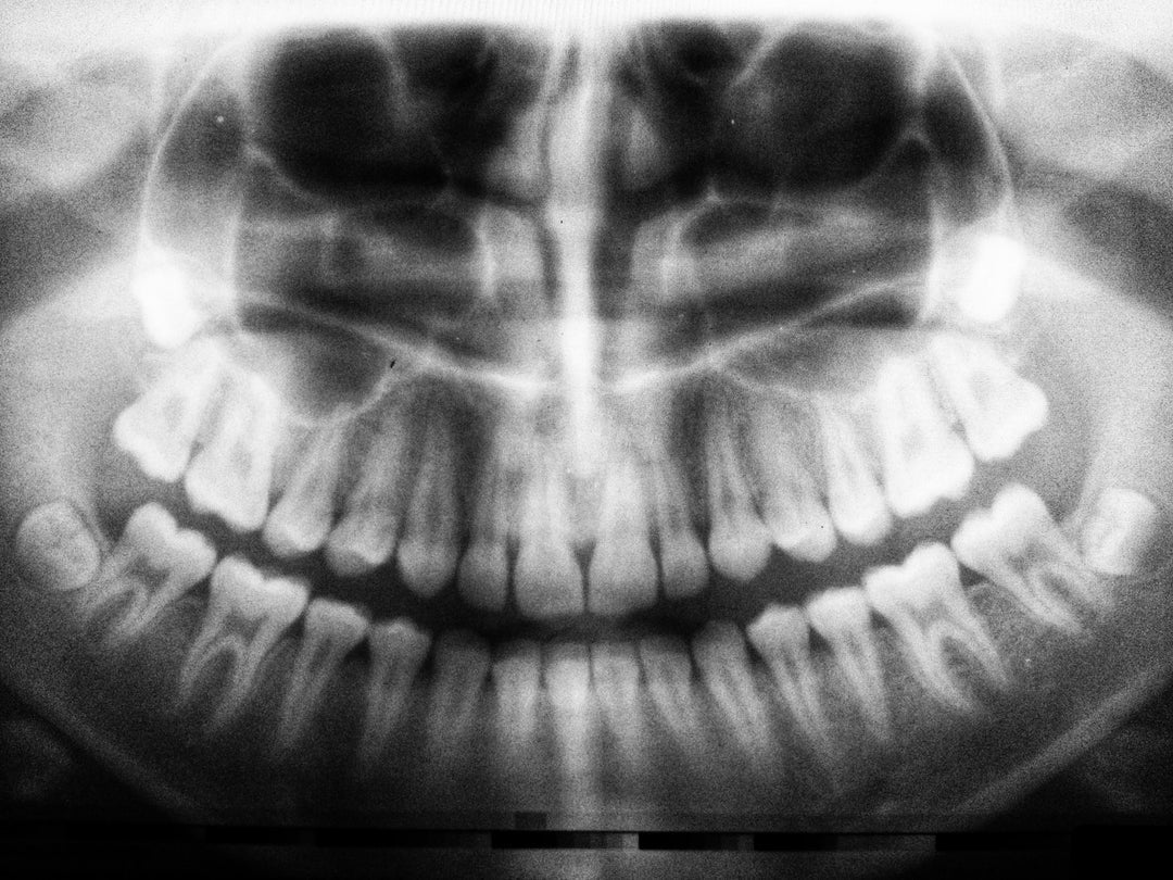 How To Stop Clenching Your Teeth: Night or Day Tips and Tricks