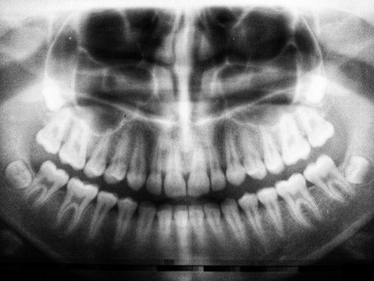 How To Stop Clenching Your Teeth: Night or Day Tips and Tricks
