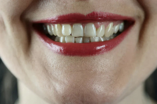 How Much Does Teeth Whitening Cost?